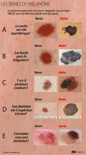 Prise en charge des lésions cutanées